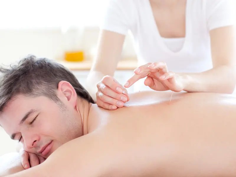 Acupunctuur behandelingen