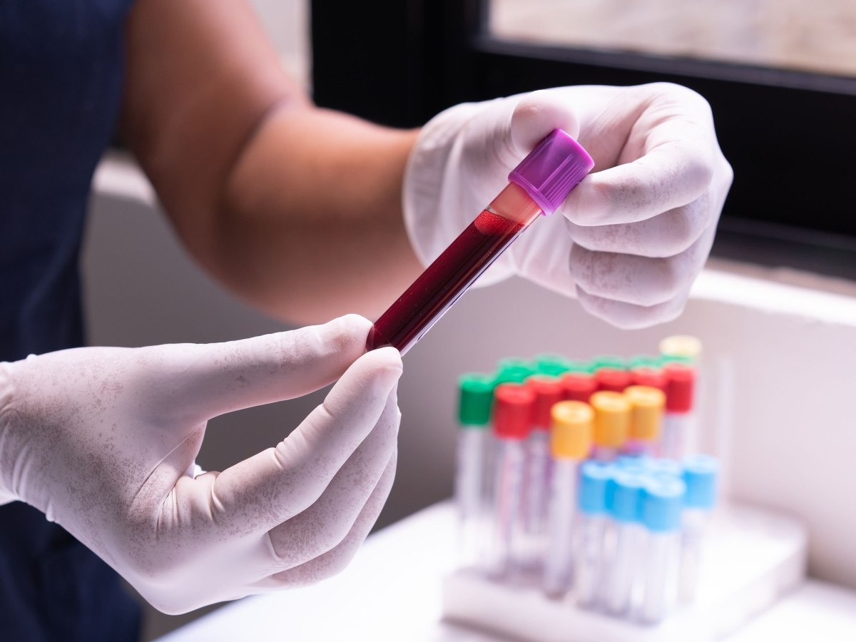 Testpakket: Algemene gezondheidsscreening